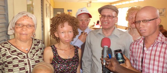 Un film-documentaire pour protéger les Albinos africains