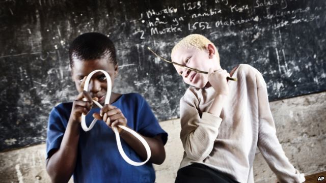 Malawi : La police autorisée à tirer sur les tueurs des albinos