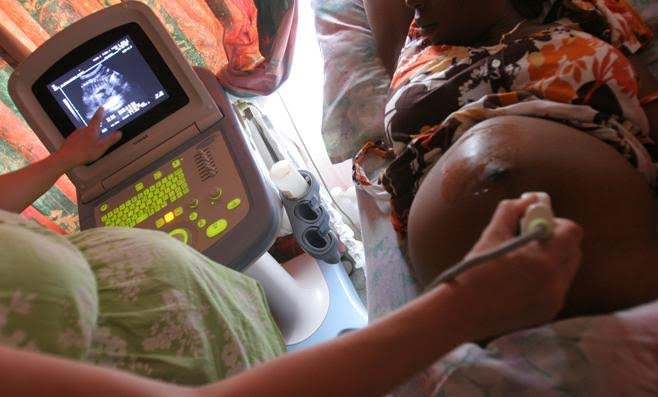 La FIDH invite le Sénégal à dépénaliser l’avortement
