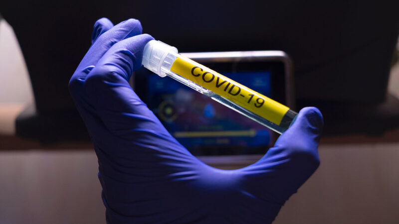COVAX Facility- OMS : Huit pays d’Afrique prêts à financer leurs doses de vaccins