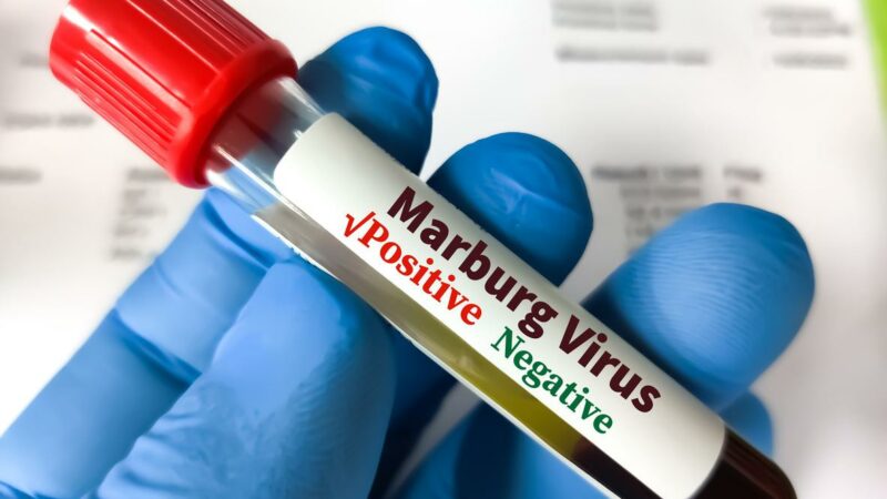 Apparition au Rwanda d’une épidémie de la maladie à virus Marburg, l’OMS rassure