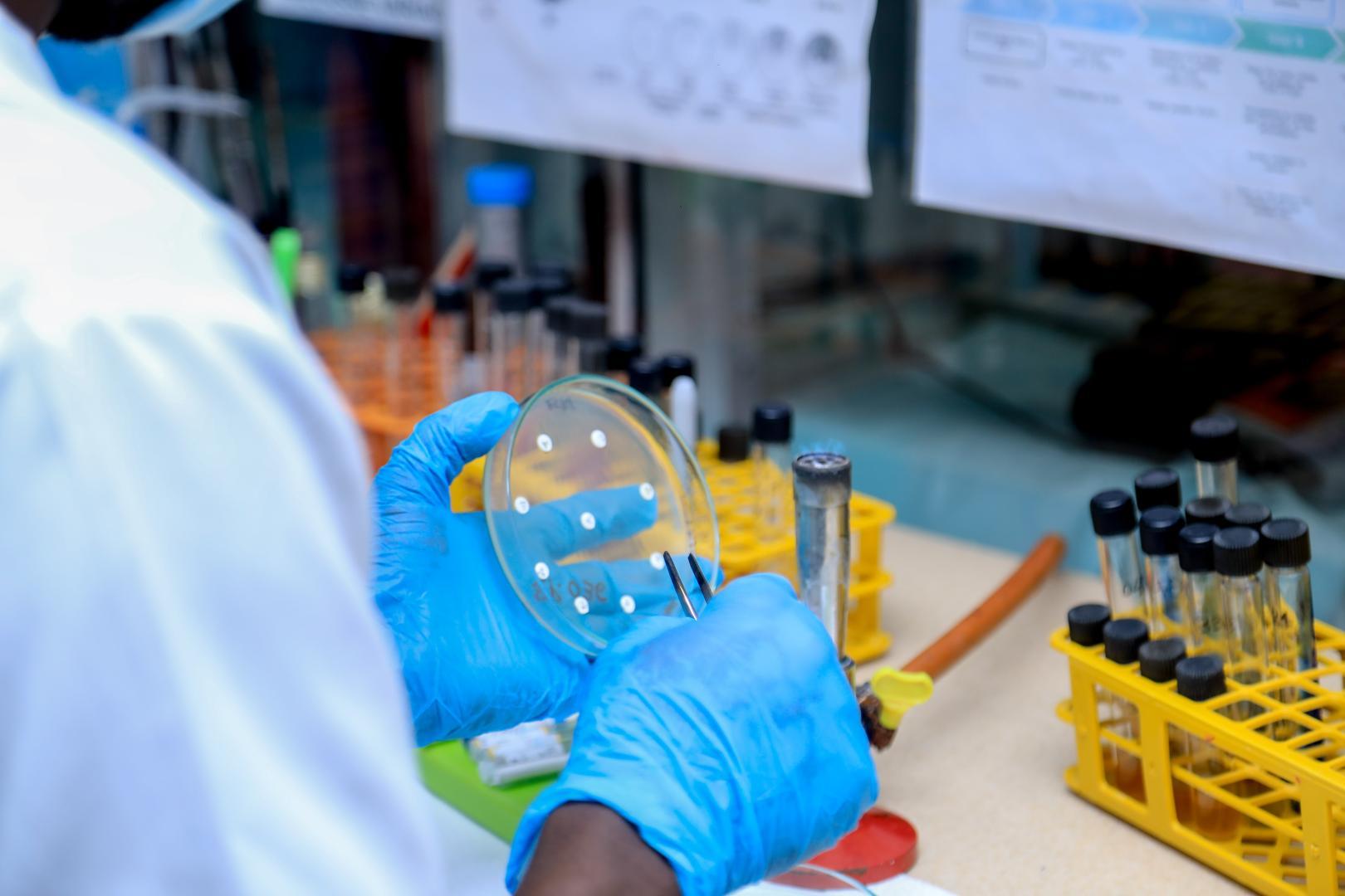 La RDC renforce sa réponse à l’épidémie du charbon après la découverte de 16 cas suspects