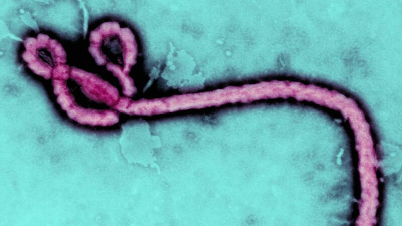 La RCA annonce une enveloppe de 20 millions USD consacrée à la riposte contre Ebola