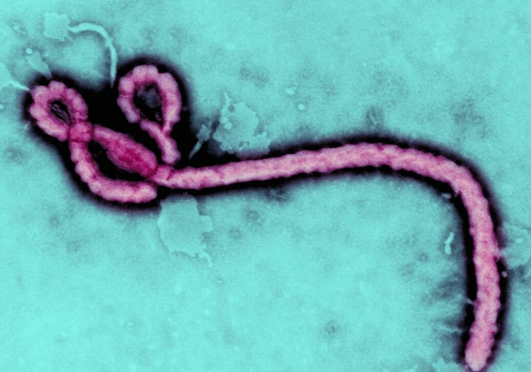 La RCA annonce une enveloppe de 20 millions USD consacrée à la riposte contre Ebola