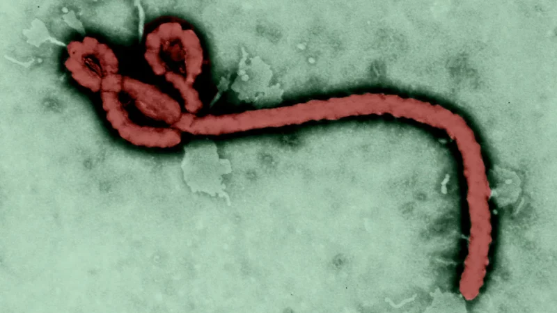 Le Nigeria invite les citoyens aux bons réflexes sans céder à la panique, après la confirmation d’un 1er cas d’Ebola à Abuja